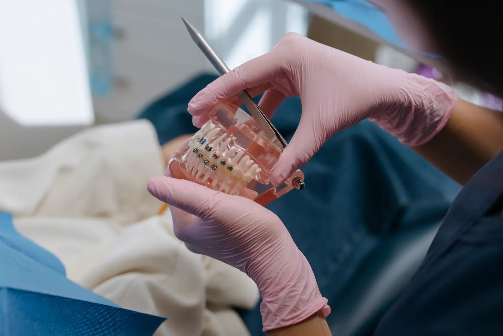 Modèle de prothèse dentaire, utile pour comprendre les couronnes
