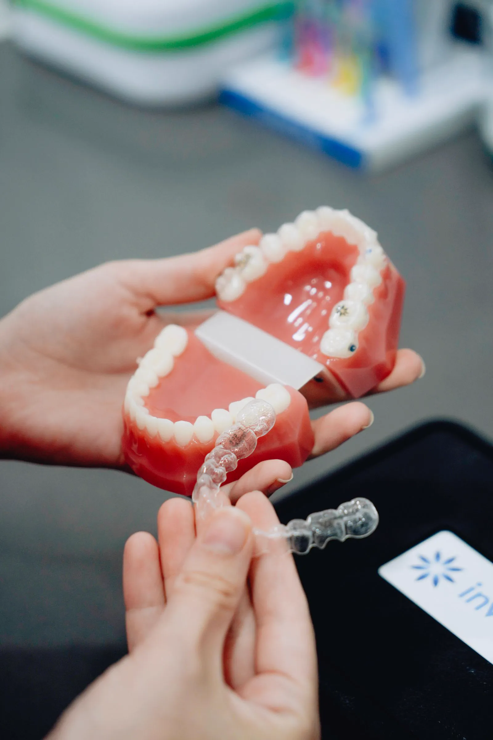 Gouttières transparentes et modèle de dents pour l'orthodontie